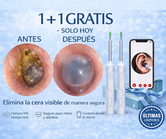 ¡Elimina la Sensación de Oído Tapado en Minutos! Con Nuestro Limpiador de Oídos Eficaz.
